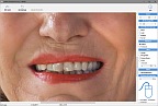 Omorphia Face Plastic Surgery Simulation Software